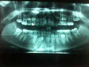 Photo 2 tk7rrl - Eugenol