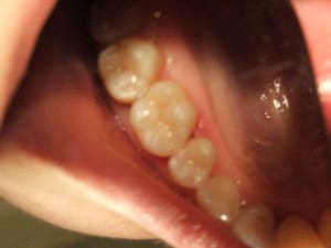 Photo toujours floue iipzgb - Eugenol