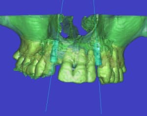 Planif euc3aq - Eugenol