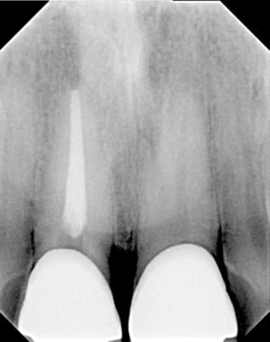 Pr  op d0fenl - Eugenol