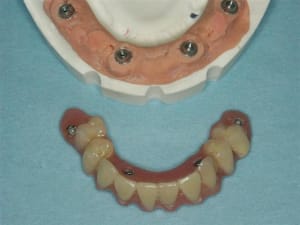 Prov  large  bfplrp - Eugenol