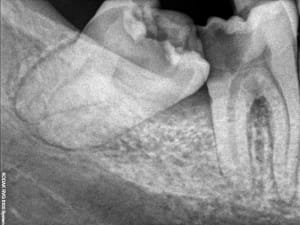 Qs0coyt4afl7u32e3wfo - Eugenol