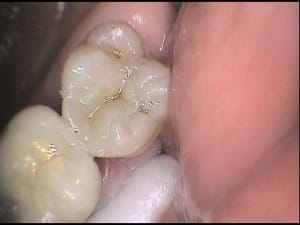 R5 sftxam - Eugenol