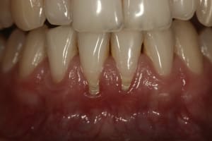R cesions2 ddxyj2 - Eugenol