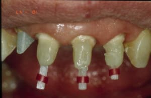 Reconstitution 2 fdsqnf - Eugenol