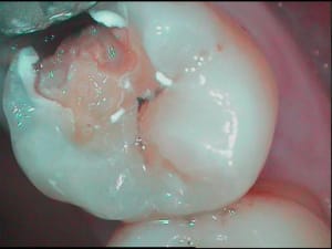 Repffff yni8ua - Eugenol
