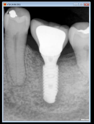 Resultat fhkd1x - Eugenol