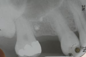 Retro avant g5t8km - Eugenol