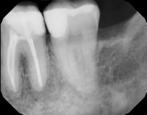 Roz4porvhsqb8jhjskd2 - Eugenol