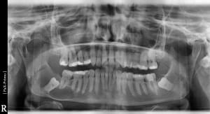 S4oo0vqw54t3iwdqaeis - Eugenol