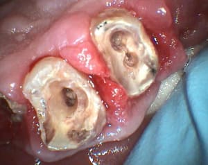 S5 pcdown - Eugenol