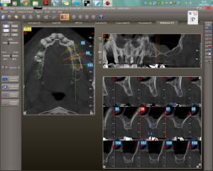 Scan gfthng - Eugenol