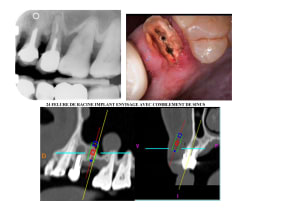 Scan ldpcns - Eugenol