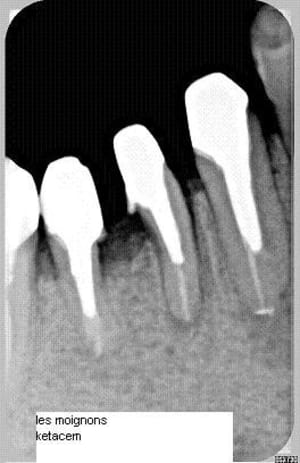 Scelt i8wjsi - Eugenol