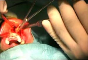 Second greffon 2 rc0x4t - Eugenol