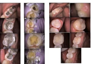 Sect 2 av pdt ap 200ko ivisru - Eugenol