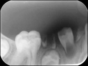 Sect4 hzma9j - Eugenol