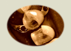 Sepia3 dx8ywy - Eugenol