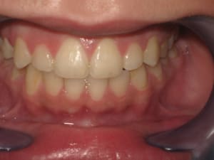 Souhani wissal fin de traitement 010 riae4g - Eugenol