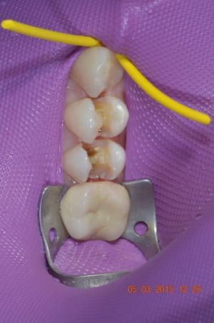 Split dam 002 s7umkb - Eugenol