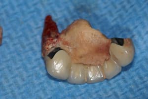 Tartre1 td3rh8 - Eugenol