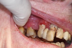 Tartre3 x6zhwh - Eugenol