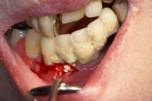 Tartre4 fd7q8h - Eugenol