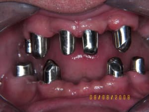 Tele primaires v5fmks - Eugenol