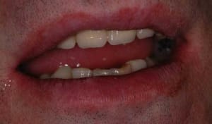 Termine uh2xhd - Eugenol