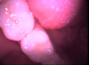 Test1 yl0xr3 - Eugenol