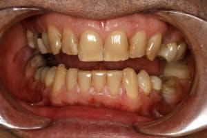 Test xscwph - Eugenol