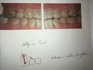 Tof eypksq - Eugenol