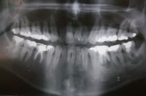 Trucmuche pwgngj - Eugenol
