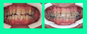 Ttt - Eugenol