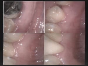 Un cas difficile paro à 30 jours 1 w2wrnj - Eugenol