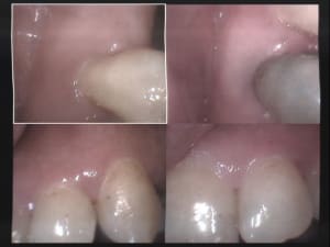 Un cas difficile paro à 8 jours 6 attention mrgzjq - Eugenol