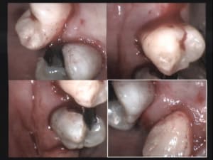 Un cas difficile paro le 1er jour 2 g7mgzw - Eugenol