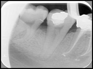 Une heure k81hmd - Eugenol