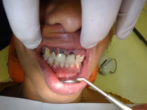 Uoakwehxwgdlrzxze4if - Eugenol