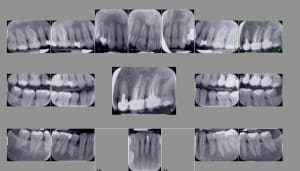 V850km9ag2lcyaevcovc - Eugenol