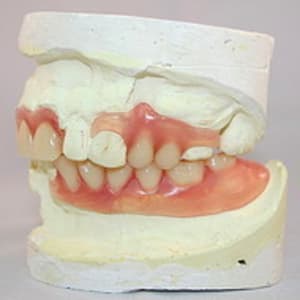 Valplast 3 btwdfi - Eugenol