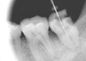 Vdvfdgwdgeqiyiy0n30s - Eugenol