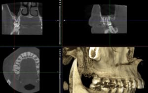 Vl44bjoxyufmm9s3uz05 - Eugenol