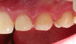 Web1 gjd9ra - Eugenol