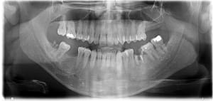 Xirmqnxibxoprguitgca - Eugenol