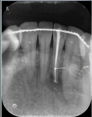Yolmmgn3awkihsv4clmc - Eugenol