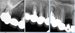 Yvenat 6 wljc49 - Eugenol