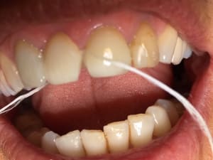 Zmyfh6votbanckqncp4v - Eugenol