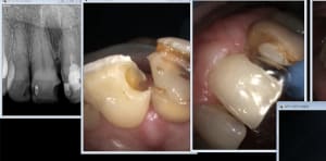 Zw0qu7pobx1l4cqa9cr7ycob8f93 - Eugenol