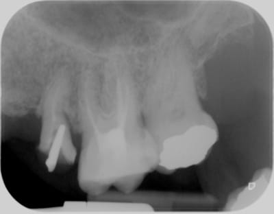  x 000017f1 3 ms1bpx - Eugenol